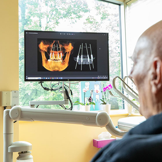 iCAT 3D CBCT